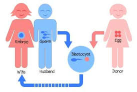 Donor Egg or Sperm IVF