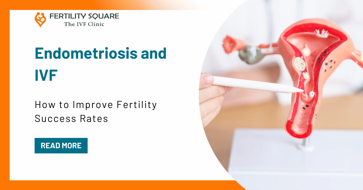 Endometriosis and IVF: How to Improve Fertility Success Rates